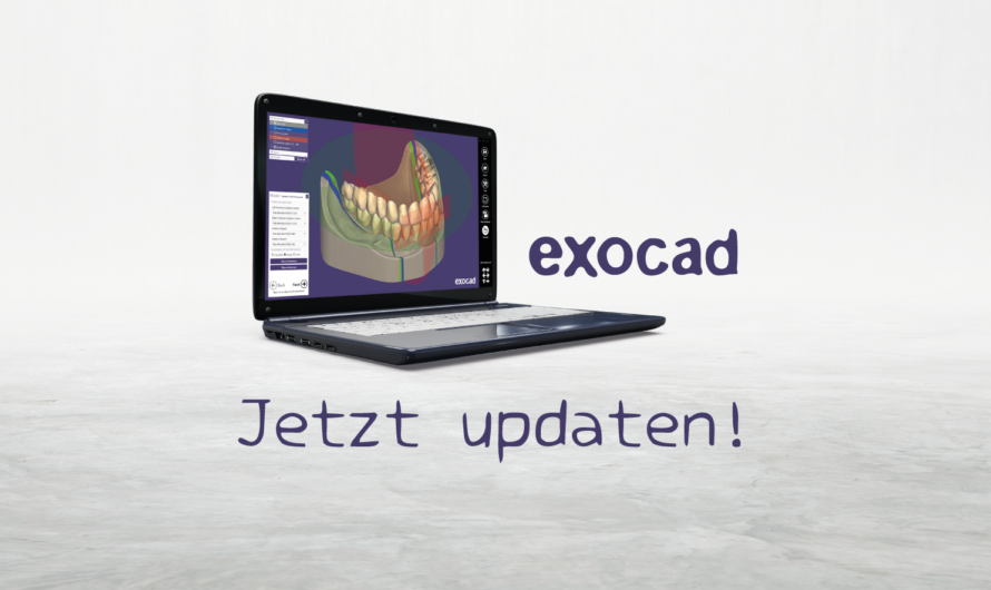 Neue Version DentalCAD 3.2 Elefsina!
