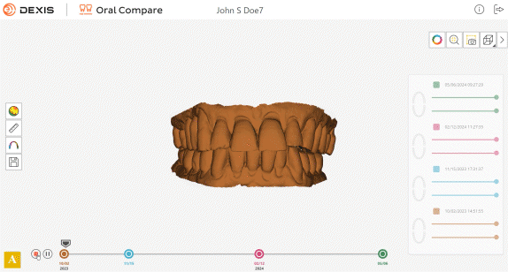 DEXIS Imprevo Scan 1