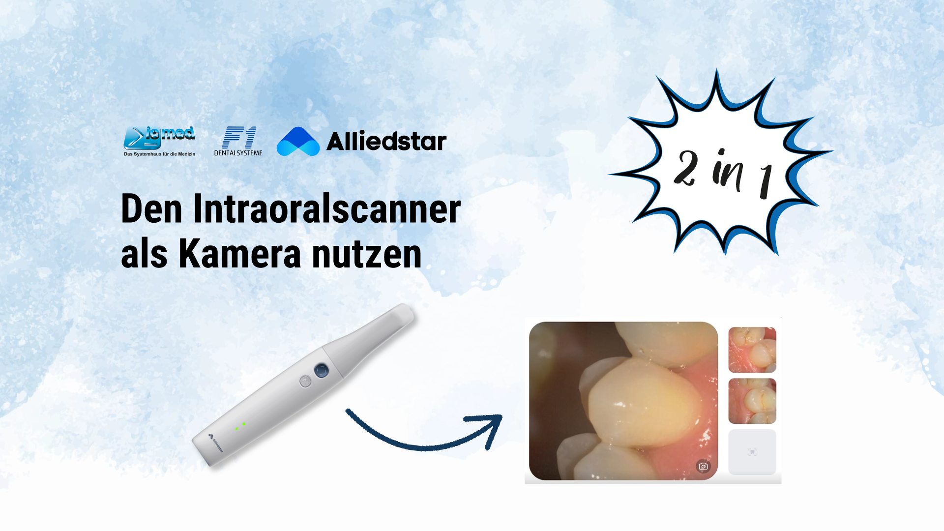 beitragsbild_intraoralscanner intraoralkamera