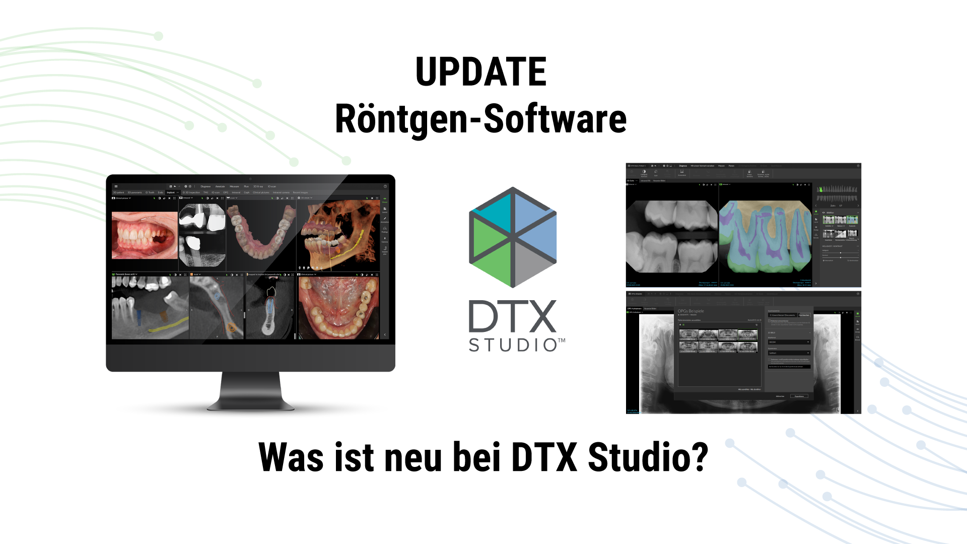 Beitragsbild DTX Update